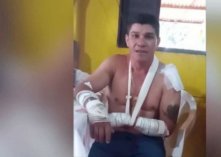 Rapaz que sobreviveu a ataque de onça conta experiência em Rio Verde de Mato Grosso